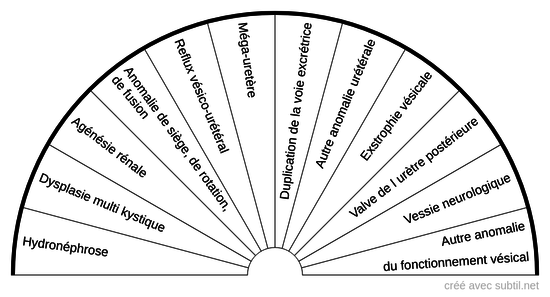 Malformation congénitale des voies urinaires
